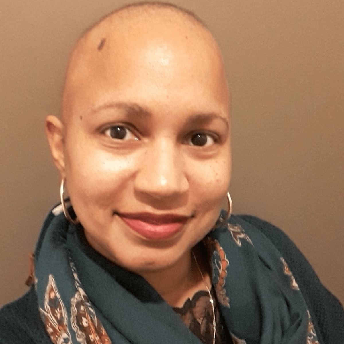 Jeune femme chauve, avec un joli sourire