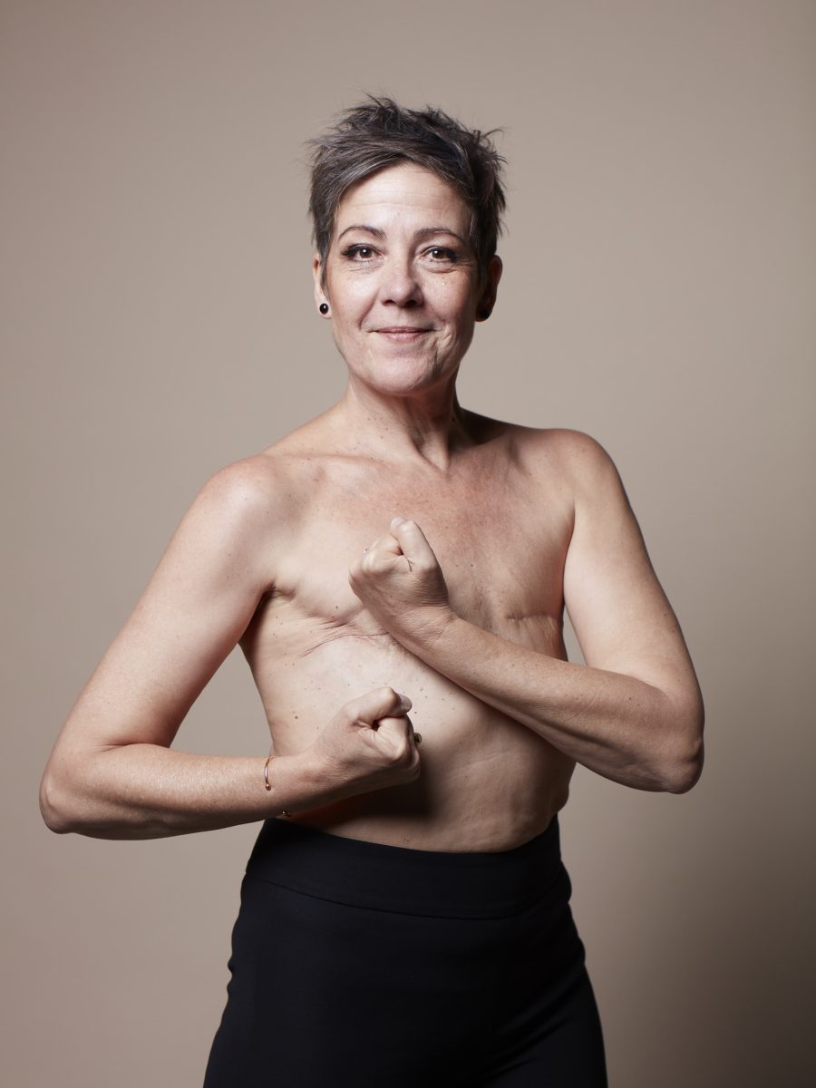 Femme cachant avec ses mains une poitrine plate